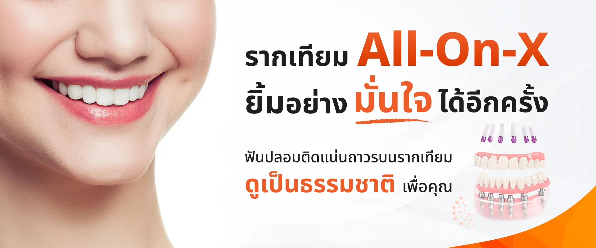 รากเทียม All-On-X ยิ้มอย่าง มั่นใจ ได้อีกครั้ง
